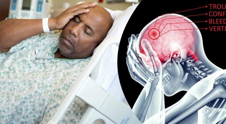 HOW TO IDENTIFY A STROKE