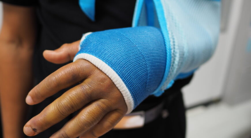 How broken bones are healed