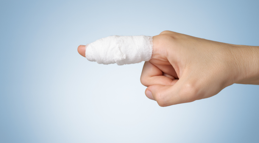 How To Tell If Your Finger Is Dislocated