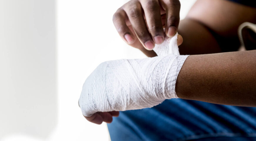 What To Do During Burn Emergencies Before Medical Help Arrives